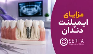 مزایای ایمپلنت دندان چیست؟ ۱۰ فایده مهم کاشت دندان و محدودیت‌ها