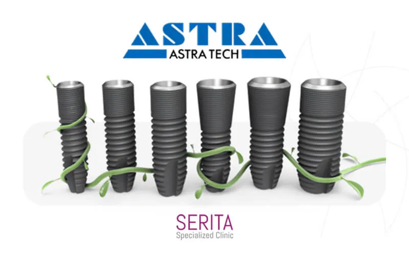 ایمپلنت آسترا تک (Previously Astra)