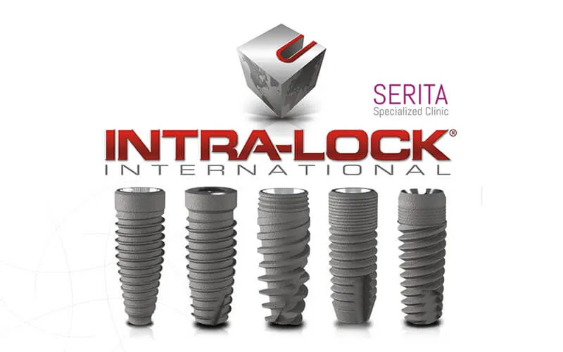 ایمپلنت اینترالاک (Intralock)