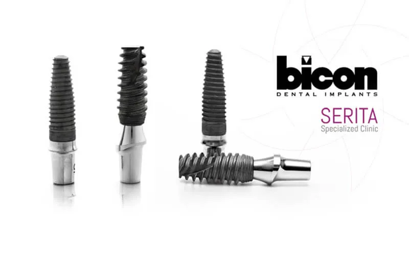  ایمپلنت بیکن (BICON)