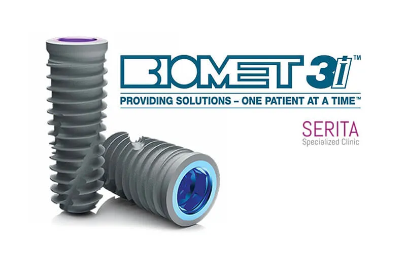  ایمپلنت بیومت تری ای (BIOMET ۳i)
