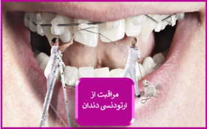 مراقبت های بعد از ارتودنسی دندان