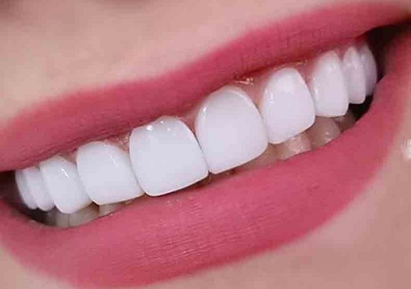 زیبایی ظاهری و اعتماد به نفس با ایمپلنت دندان