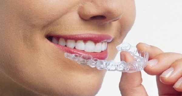 روش خانگی (in home) بلیچینگ دندان