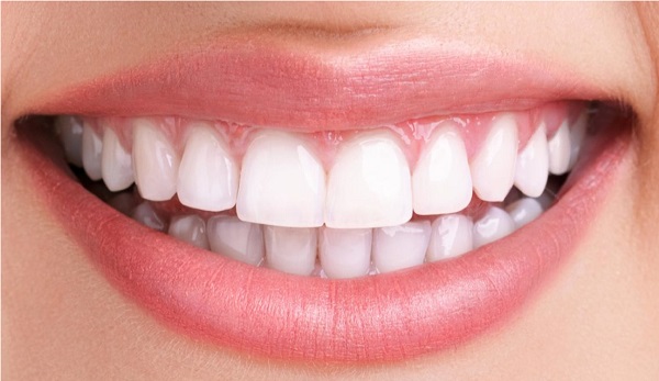 فرق لمینت و ایمپلنت,کجی دندان,مال اکلوژن (مشکلات فک و دندان)
