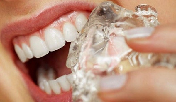 پوسیدگی دندان,درد دندان,شایع ترین مشکلات دندان