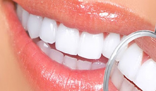 مراقبت های بعد از لومینیرز دندان 