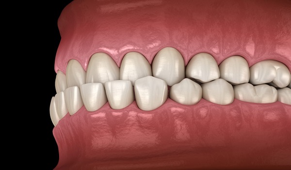 ارتودنسی دندان,بهداشت دهان و دندان,درد دندان