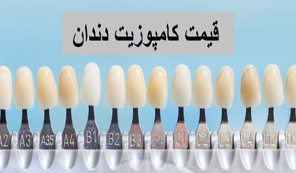 قیمت کامپوزیت دندان