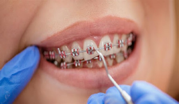 بهترین متخصص ارتودنسی دندان تهران