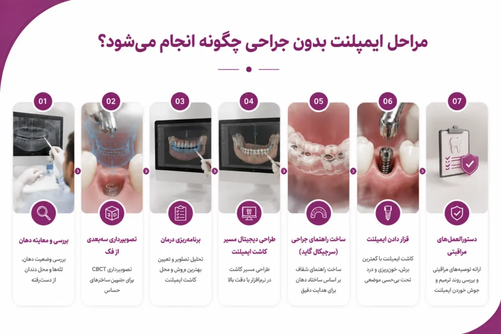 مراحل ایمپلنت بدون جراحی