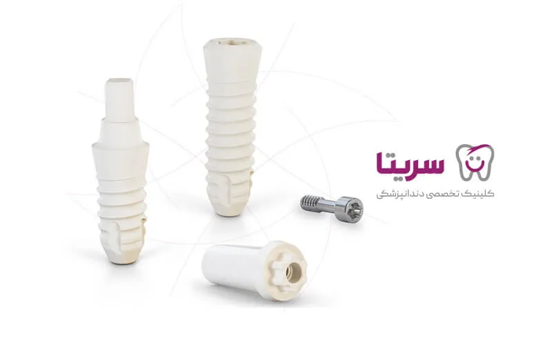 فیکسچر و ایمپلنت زیرکونیا