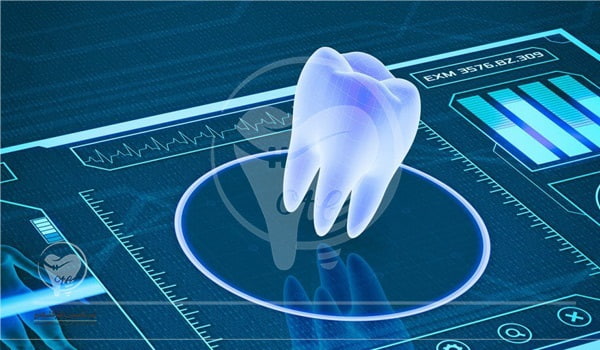ایمپلنت بدون جراحی از روش های کاشت دندان است.