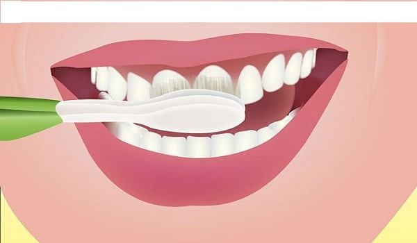 رعایت بهداشت دهان و دندان می تواند از نارسائی ایمپلنت دندان جلوگیری کند