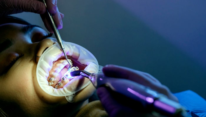 ارتودنسی دندان در کلینیک دندانپزشکی
