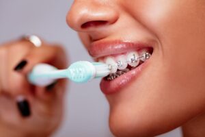 نحوه مسواک زدن و کشیدن نخ دندان در طول ارتودنسی دندان