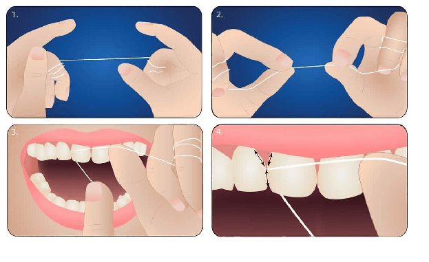 مراحل نخ دندان کشیدن به طرز صحیح