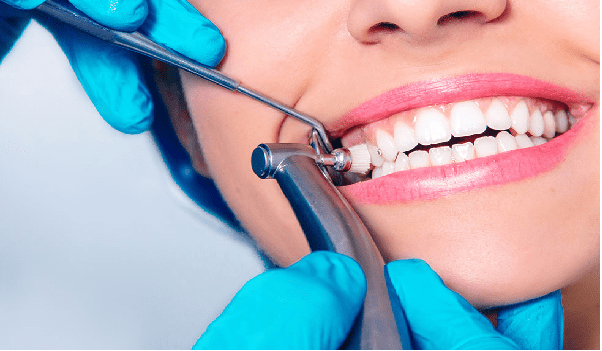 مرحله پالیش دندان، به منظور تمیز کردن سطح دندان انجام می شود