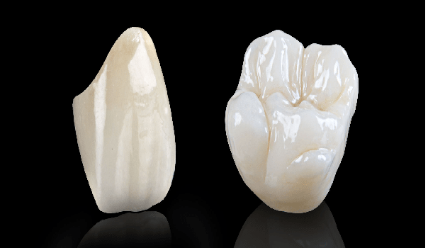 یکی از انواع بریج دندانِ؛ بریج سرامیکی است