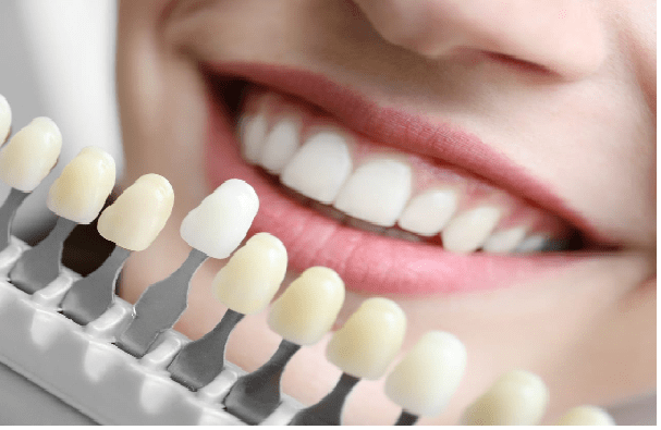 درمان فاصله بین دندان,شایع ترین مشکلات دندان,عوارض خدمات دندانپزشکی