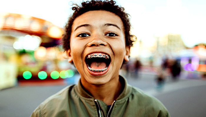 ظاهر زشت دندان ها هنگام خندیدن، از معایب ارتودنسی دندان
