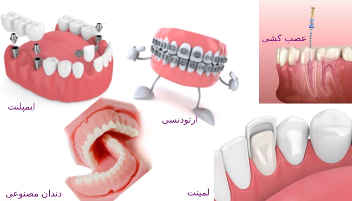خدمات دندانپزشکی عبارتند از؛ پرکردن، عصب کشی، ایمپنلت، ارتودنسی و... .