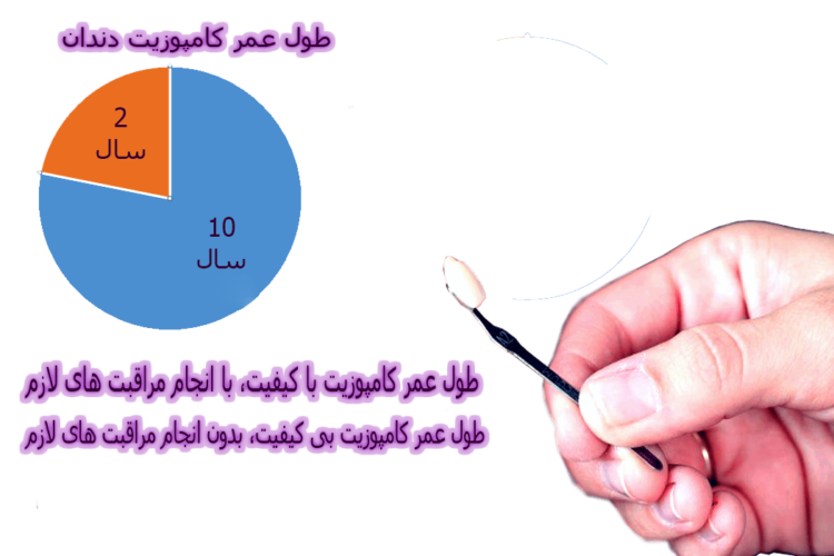 طول عمر کامپوزیت دندان