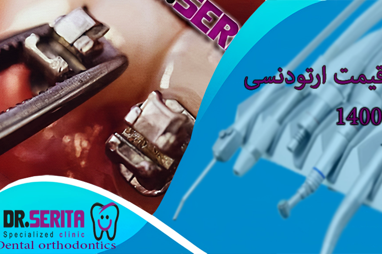 قیمت ارتودنسی دندان