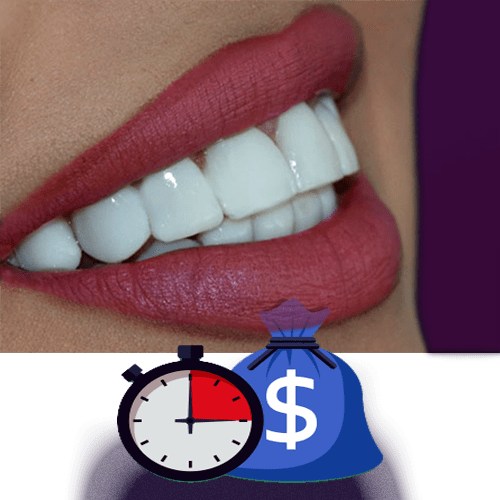 پرداخت قسطی هزینه لمینت در کلینیک دکتر سریتا