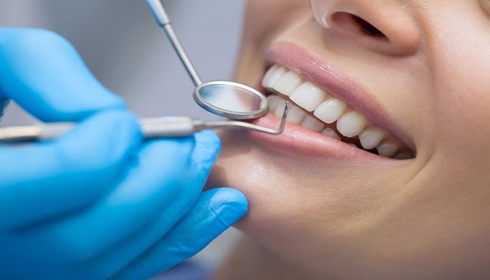 چکاپ دندان؛ یکی از خدمات کلینیک دندانپزشکی.
