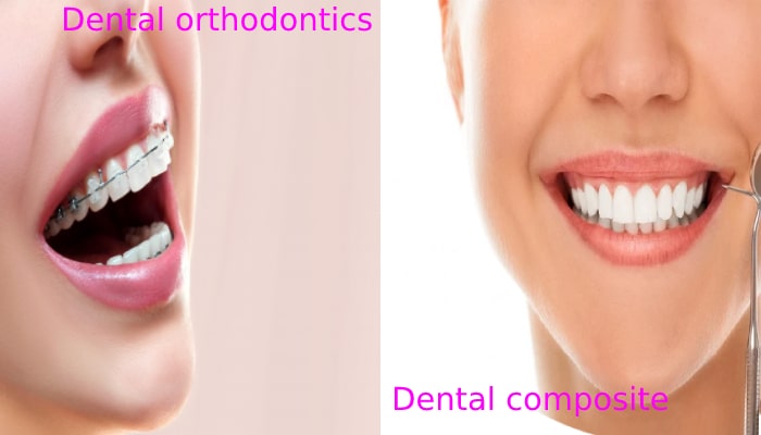 ماندگاری درمان ارتودنسی دندان