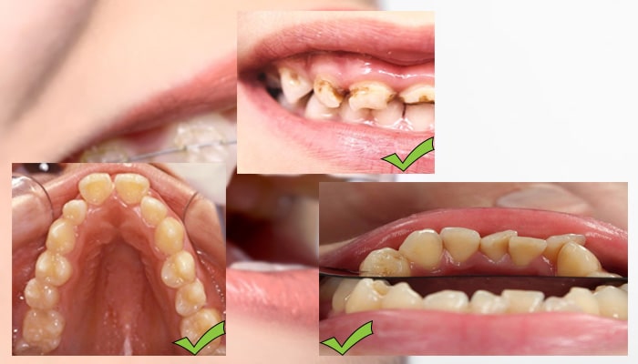 اهمیت ارتودنسی دندان