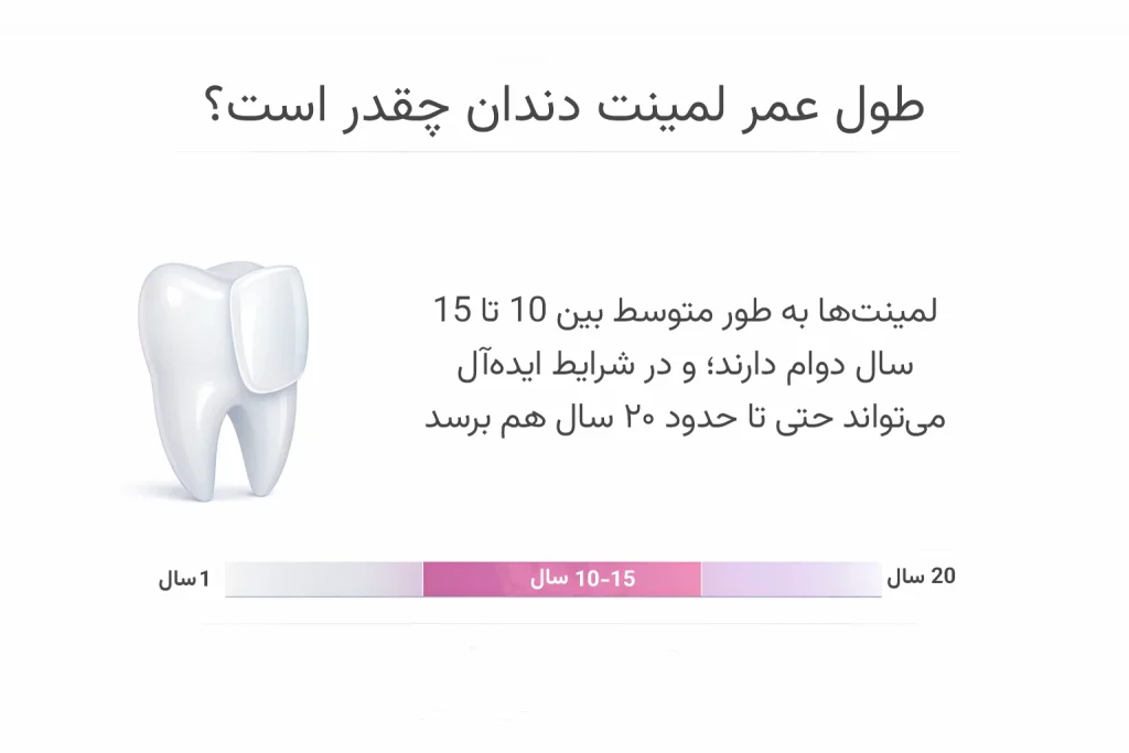 اینفوگرافیک طول عمر لمینت دندان