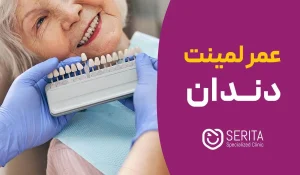 عمر لمینت دندان چقدر است؟ | عوامل مؤثر و نگهداری لمینت دندان