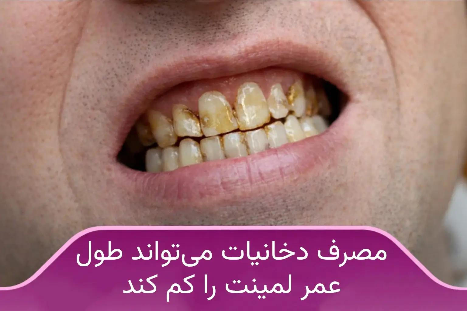 مصرف دخانیات را کم کنید