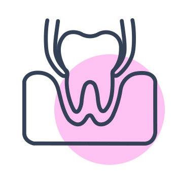 کشیدن دندان قیبل از ایمپلنت
