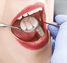 معاینه قبل از کامپوزیت دندان