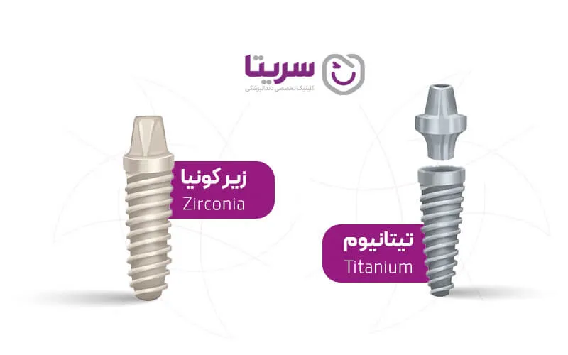 ایمپلنت زیرکونیا و تیتانیوم سرطانزا نیستند!