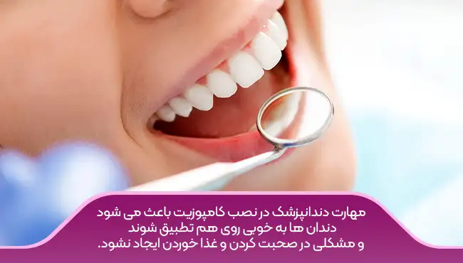مهارت متخصص کامپوزیت دندان - تطبیق دندان در کامپوزیت