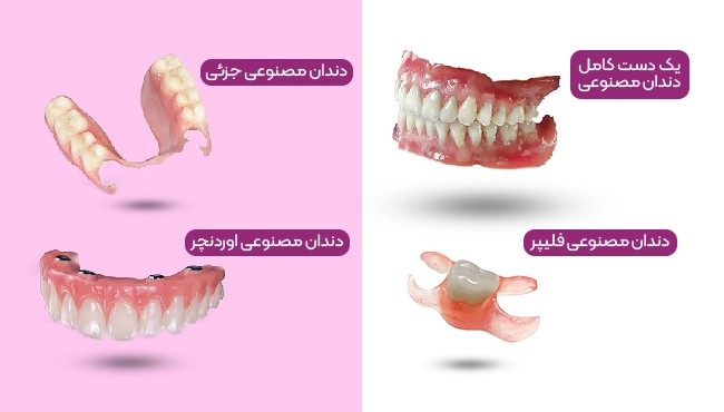 انواع دندان های مصنوعی