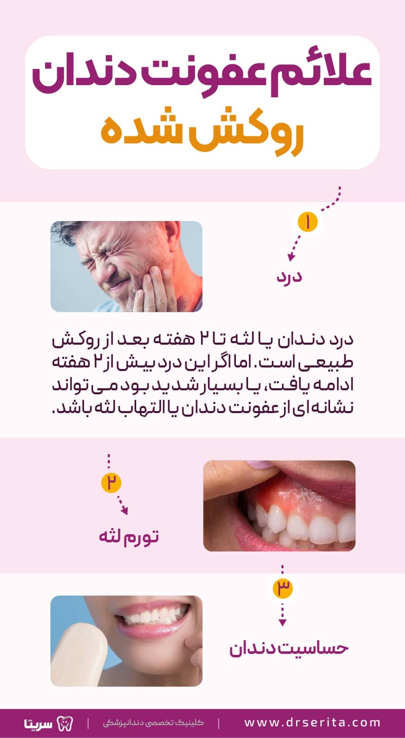 علائم عفونت دندان روکش شده، 3 مورد از علائم عفونت دندان روکش دار