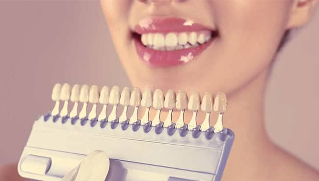 مهمترین مزایا و معایب لمینت دندان