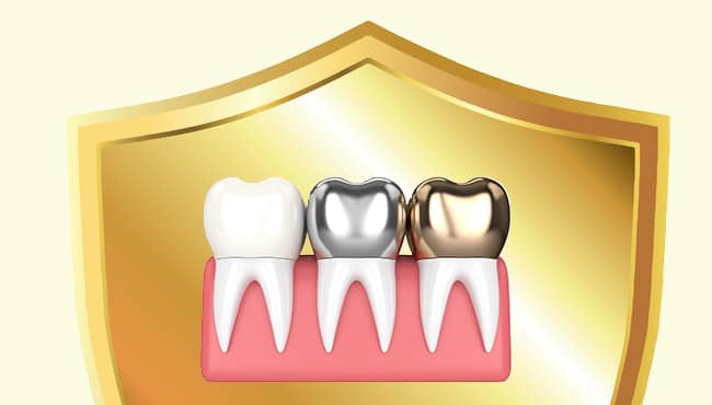 تفاوت دوام و ماندگاری روکش دندان با لمینت دندان