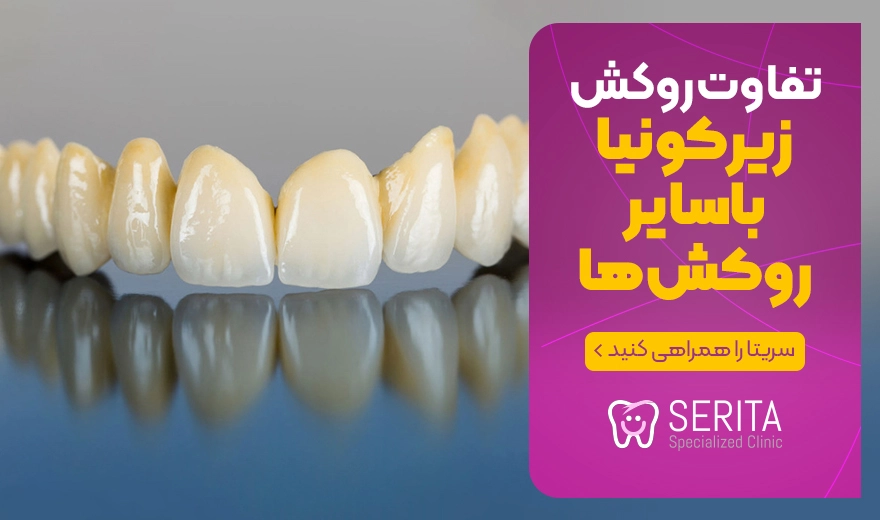 تفاوت و فرق روکش زیرکونیا با سایر روکش های دندان