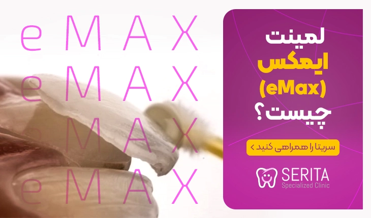 لمینت ایمکس (eMax) چیست؟ نحوه ساخت، نصب، مزایا و قیمت