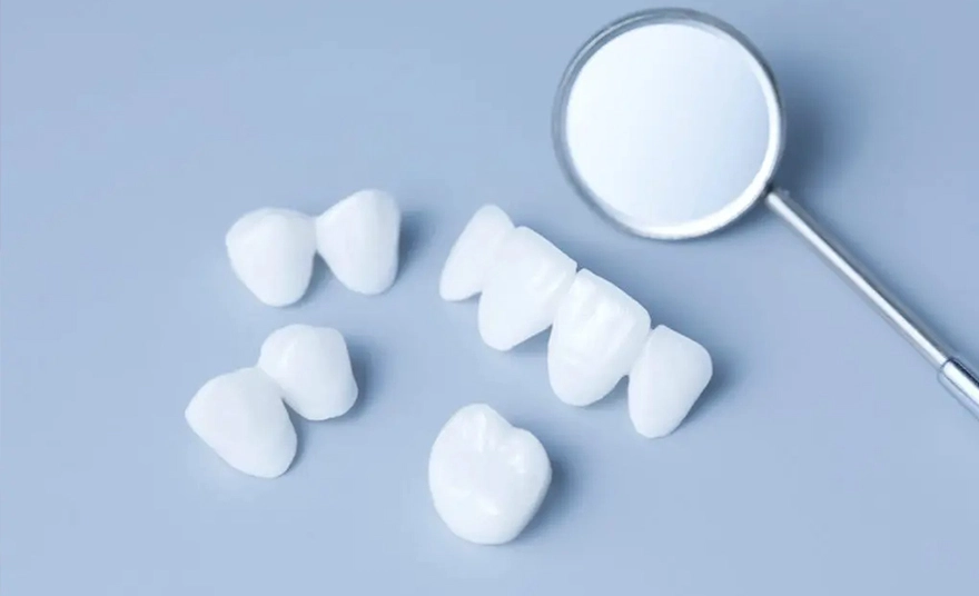 مراحل نصب لمینت دندان در کلینیک سریتا