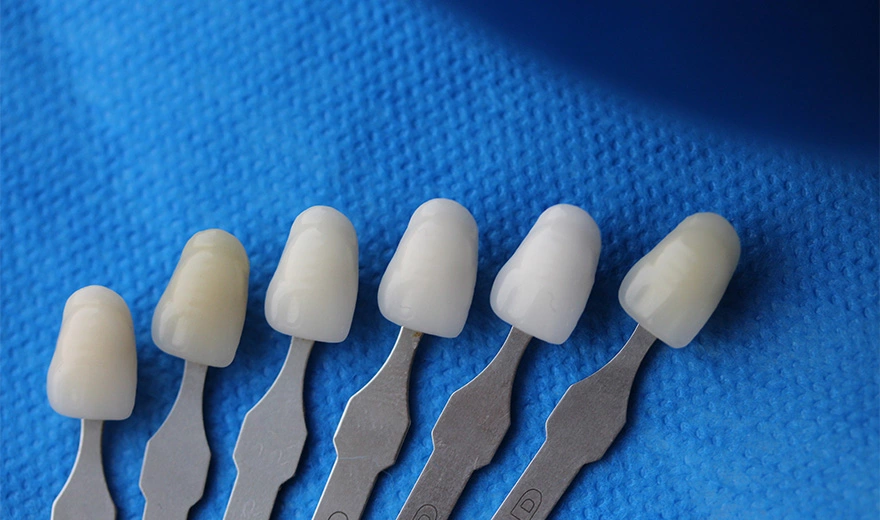 انواع برند و مارک و نوع لمینت دندان در کلینیک سریتا