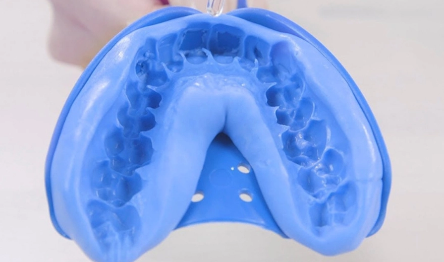 مرحله قالبگیری از دندان برای لمینت دندان