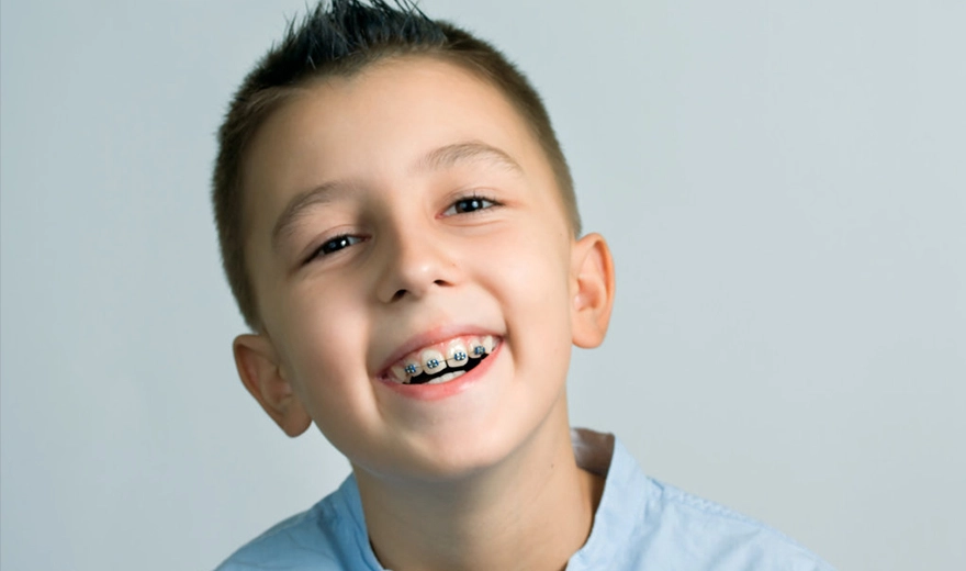 پیشگیری از ایجاد فاصله در دندان و دیاستم در کودک و کودکان
