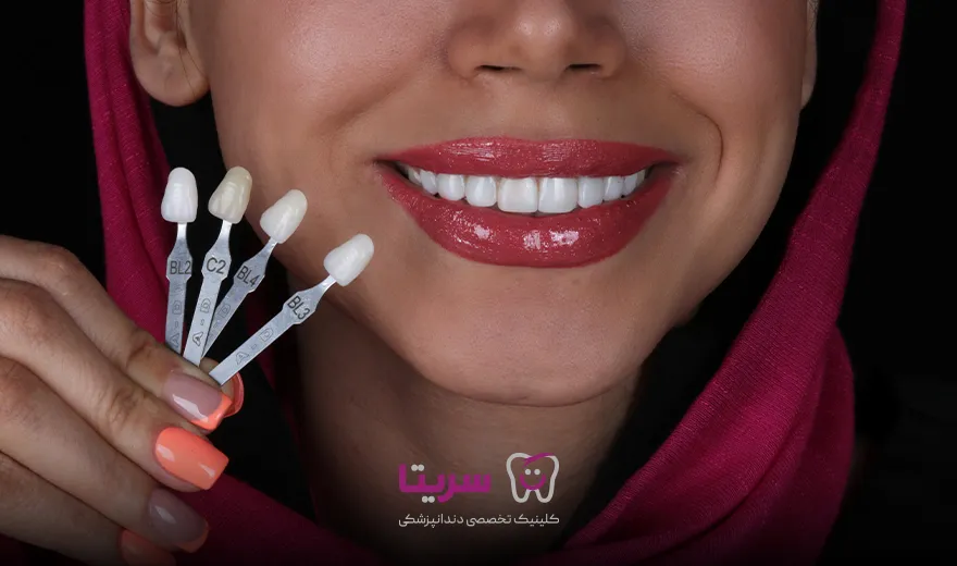 انتخاب رنگ کامپوزیت دندان به روش لیرینگ